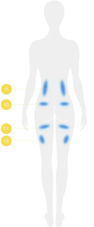 CoolSculpting fat freezing Dublin - back body diagram with numbered treatable fat areas Back body diagram with numbered treatable fat areas for CoolSculpting fat freezing in Dublin